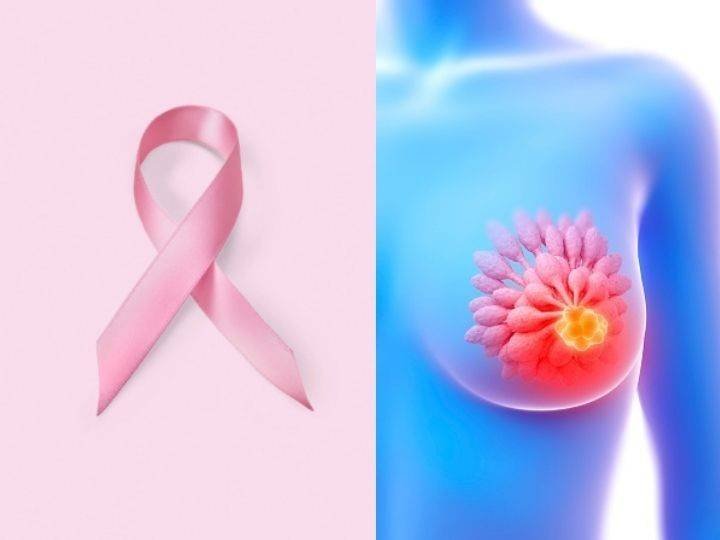 Remarcan la importancia de realizar test de control para prevenir el cáncer de mama