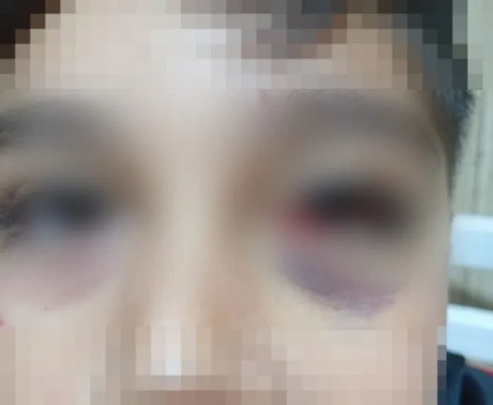 Conmoción en un colegio de Mar del Plata: un alumno atacó a un compañero con una lapicera en plena clase